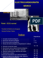 Electrocardiogram A