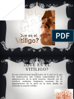 Taller Vitiligo