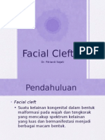 Referat Facial Cleft