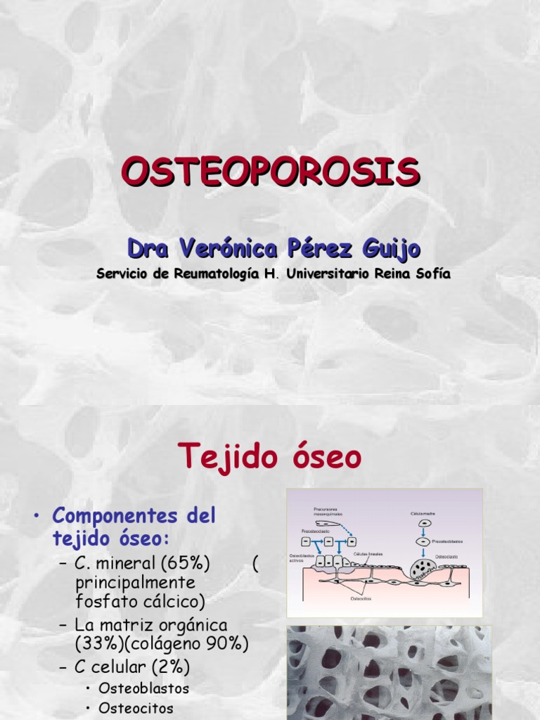 Guía Completa sobre Osteoporosis | PDF | Osteoporosis | Hueso