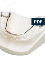 Extracciones Seriadas Dentición Mixta