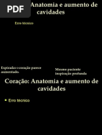 CORAÇÃO- Interstício M5