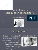 What Is Assisted Reproduction Technology?