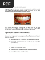 Download Cara Cepat Memutihkan Gigi Secara Alami by Febyanne Vasilefa SN269968757 doc pdf