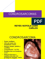 Condrosarcoma Presentacion