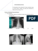 PNEUMOMEDIASTINUM