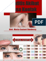 Keratitis Akibat Lensa Kontak