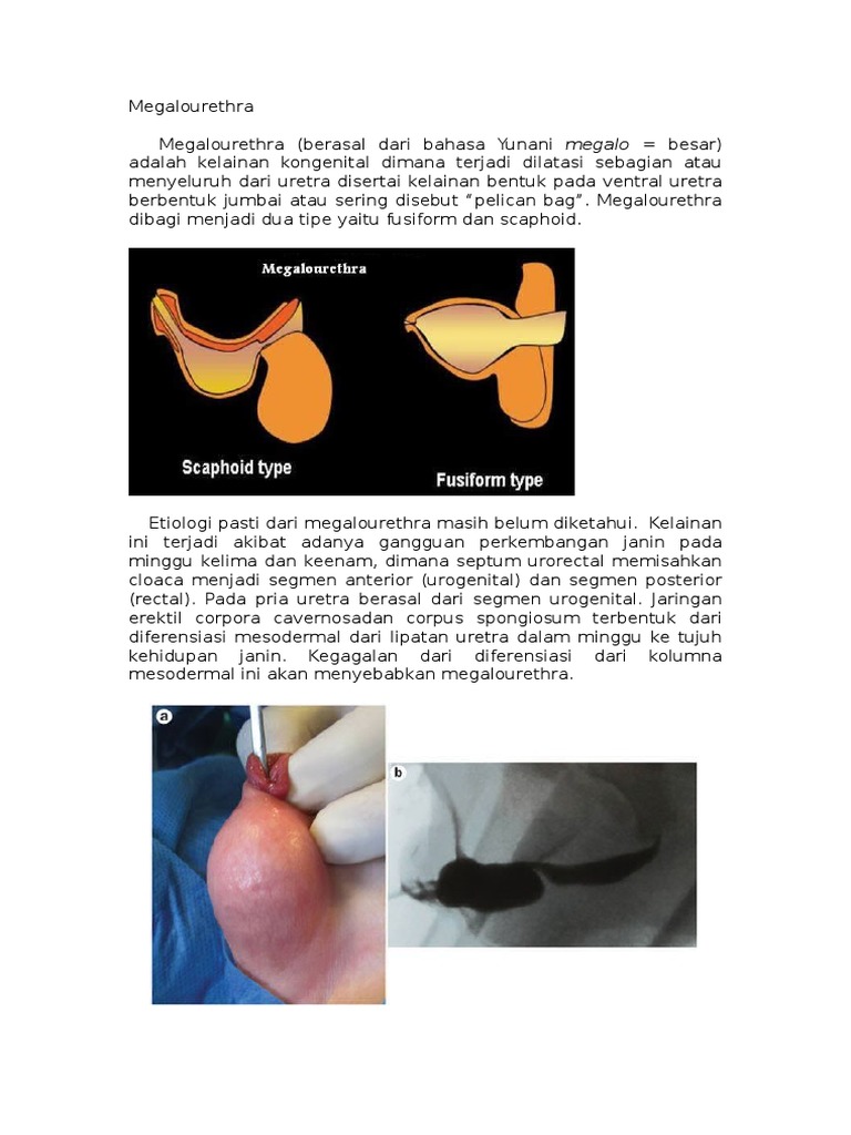 Ekstremal uretral jinsiy aloqa