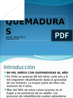 Quemaduras