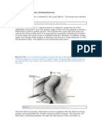 Cholecystectomy