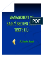 Management of Badly Broken Down Teeth II