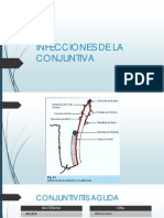 Infecciones de La Conjuntiva