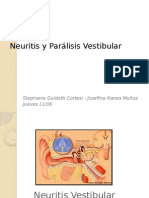 Neuritis y Parálisis Vestibular