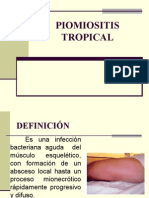 Piomiositis Tropical