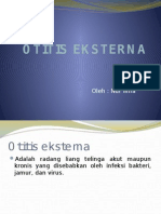 Otitis Eksterna