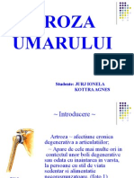 Artroza Umarului