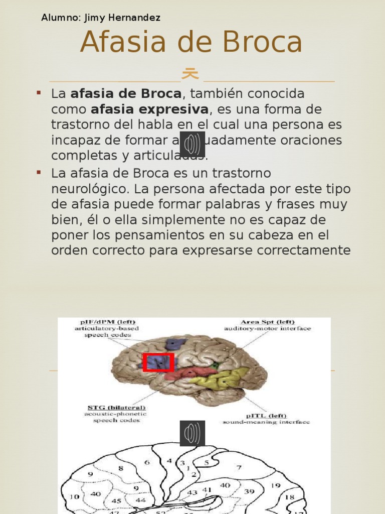 Afasia De Broca Aphasia Neurology