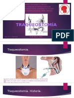 Seminario Traqueostomia