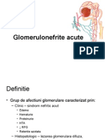 C30 Glomerulonefrite
