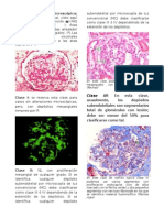 Microscopía renal normal y clasificación de nefritis lúpica