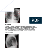 Chest X-Ray: AP Projection