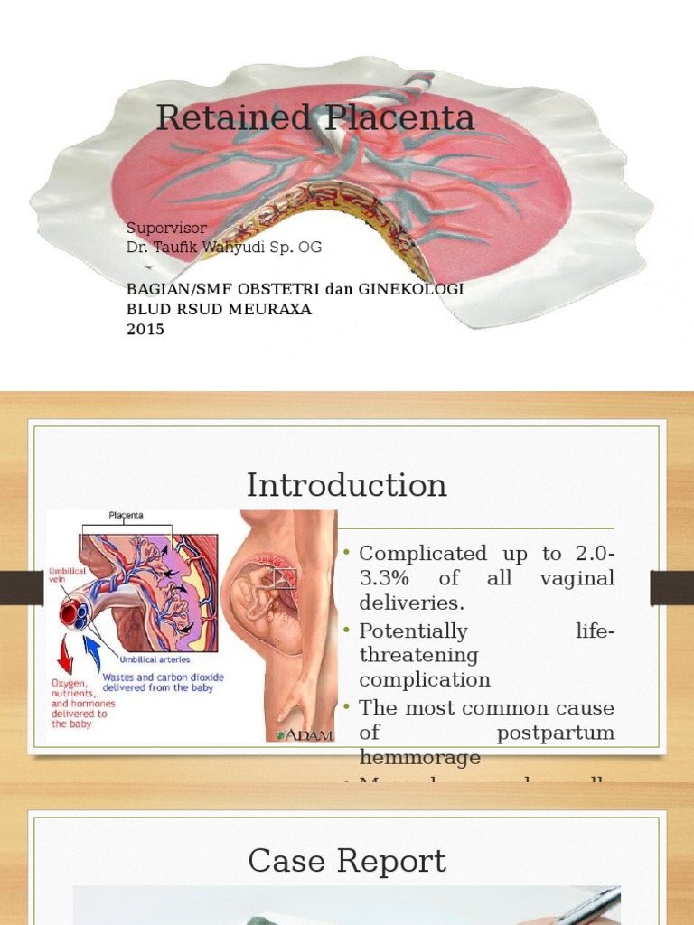 Retained Placenta