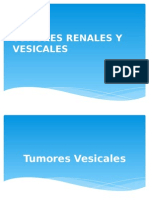 Tumores Renales y Vesicales