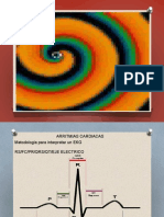 ARRITMIAS CARDIACAS