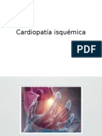 cardiopatia isquemica