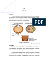 Uveitis