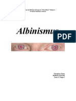 Albinism Us