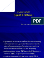 กระดูกสันหลังหัก (Spine Fracture)