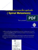 โรคมะเร็งแพร่กระจายมาที่กระดูกสันหลัง (Spinal Metastasis)