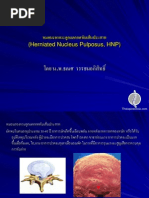 Download  Herniated Nucleus Pulposus HNP by thaispineclinic SN27233020 doc pdf