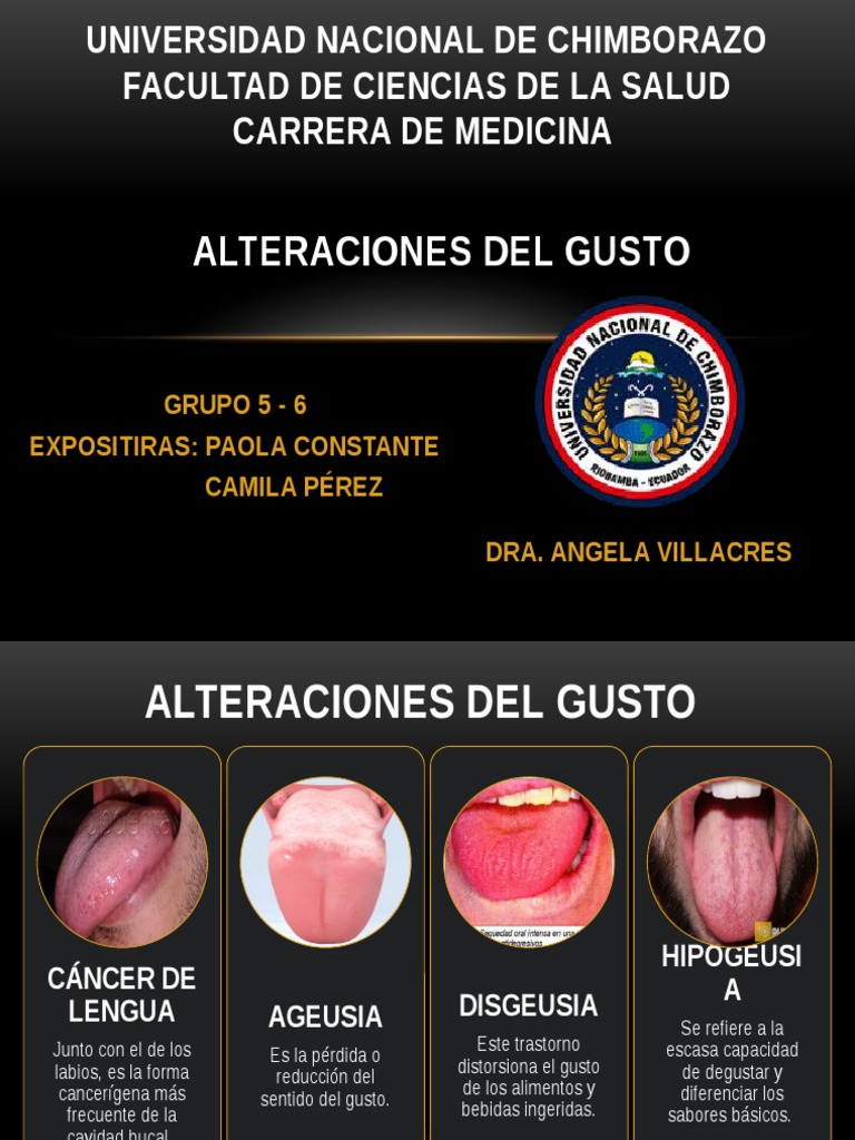 Alteraciones Del Gusto Gusto Medicina CLINICA