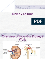 Kidney Failure