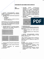 LP 2 Ischemia Blocurile Si Modificari ECG Induse de Medicamente