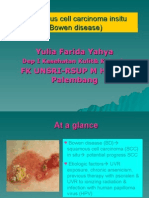 Squamous Cell Carcinoma Insitu (Bowen Disease)