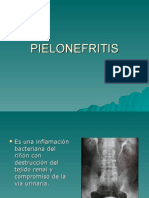 pielonefritis (1)