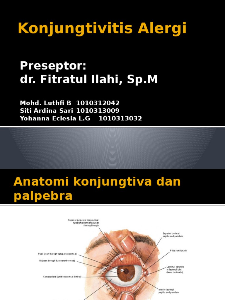 Konjungtivitis Alergi PDF