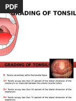 Tonsil Grading Scale Explained Pdf 