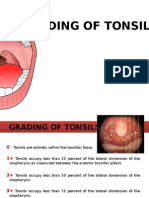 Grading of Tonsil