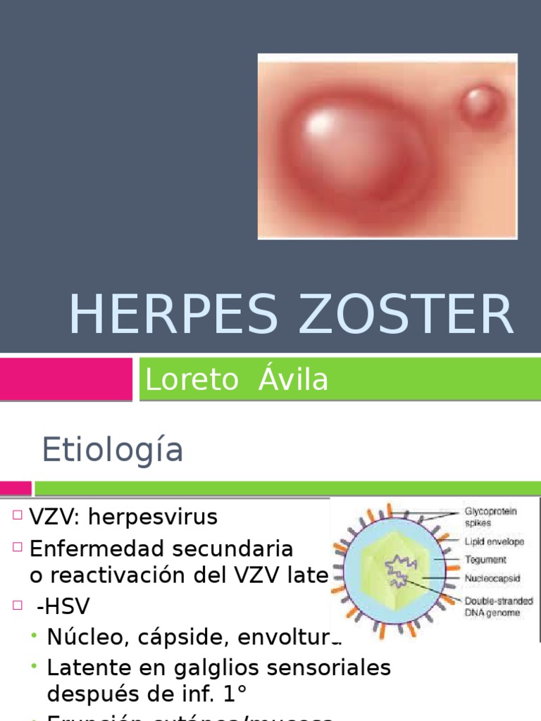 Herpes zoster.pptx Salud pública Especialidades Medicas
