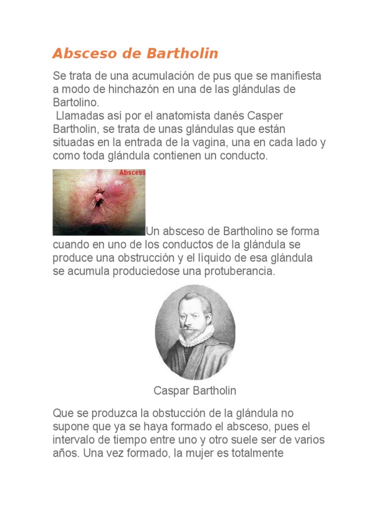 Absceso de Bartholin PDF Cáncer Vagina