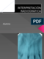 INTERPRETACIÓN RADIOGRÁFICA.pptx