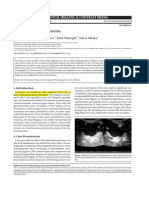 Mature Cystic Renal Teratoma