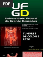 Tumores de Cólon e Reto