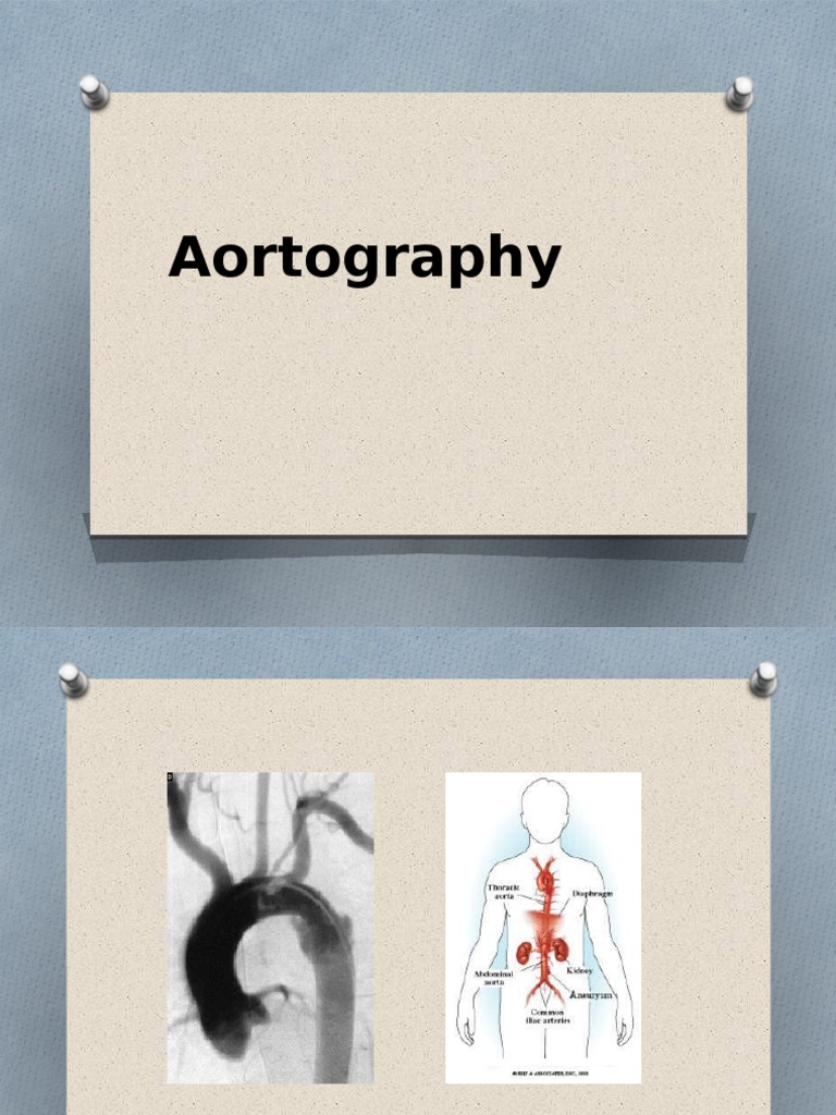 Aortography | PDF | Angiography | Health Sciences