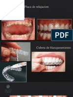 Clasificación de maloclusiones dentales y sus tratamientos