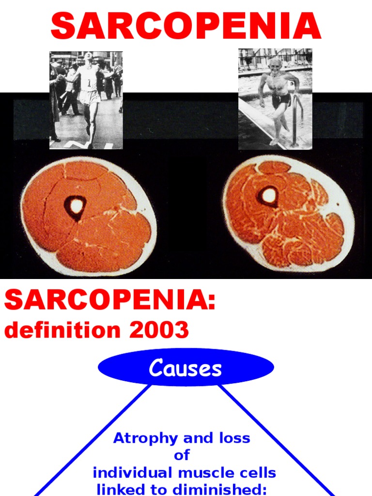 sarkopenia | Earth & Life Sciences | Biology